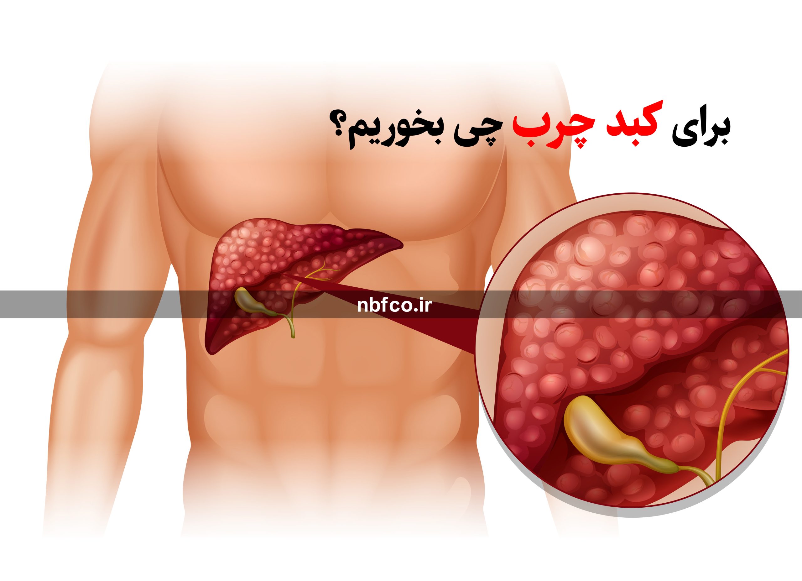 برای کبدچرب چی بخوریم؟